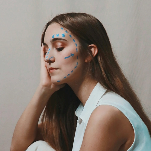 Hydrolift mit Radiesse – Liquid Facelift